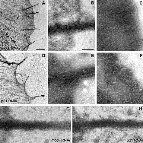 Filopodia formation in Dictyostelium cells lacking Scar and Nap1. (A ...