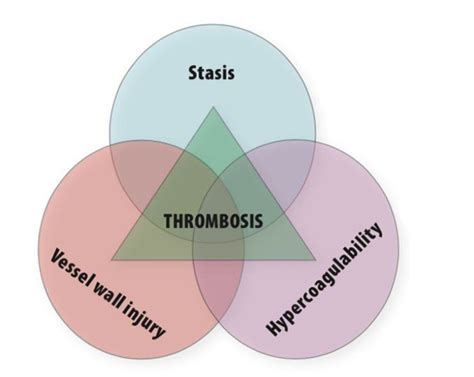 How to Lower Your Risk of a Dangerous Blood Clot - Heart Advisor