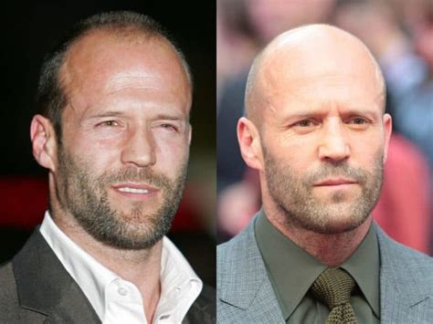 Jason Statham Iconic Balding Buzz Cut & Beard Style - Bald & Beards