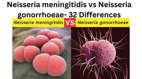 Neisseria meningitidis vs Neisseria gonorrhoeae 32 Differences - YouTube