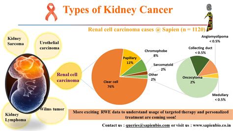 Types of Kidney Cancer – Sapien Biosciences