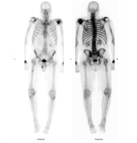 Part 8 Bone | Radiology Key