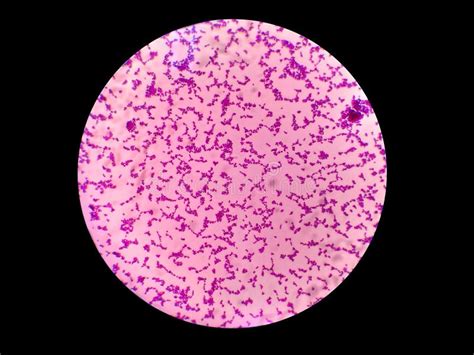 Gram Positive Cocci Bacteria