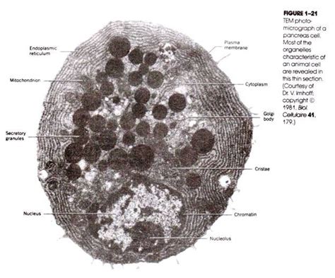 Electron Microscope Labelled Diagram