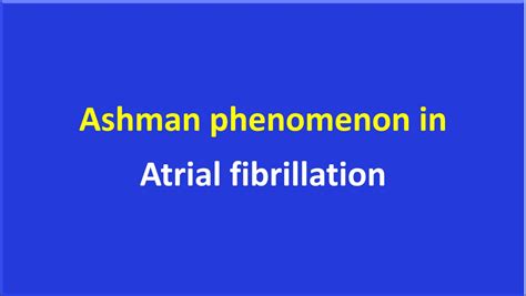 Ashman phenomenon in atrial fibrillation - may resemble VPC