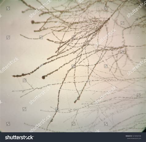 Mycelium Under Microscope Fungal Biology Microscopy Stock Photo ...