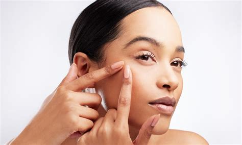 Five of the best pimple patches and how to use them | MiNDFOOD