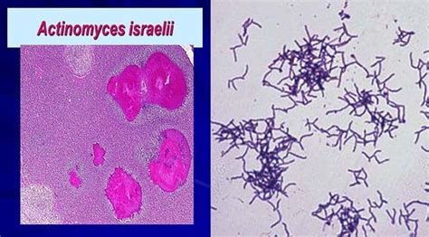 Biochemical Test of Actinomyces israelii