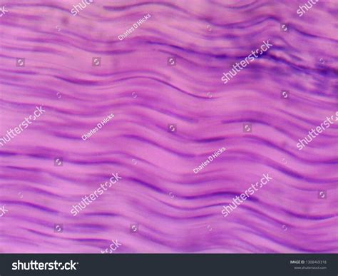 8 Dense regular connective tissue Images, Stock Photos & Vectors | Shutterstock