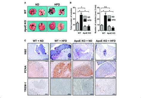 | Effect of ApoE knockout on B16F10 lung metastasis. (A,B) B16F10 cells... | Download Scientific ...