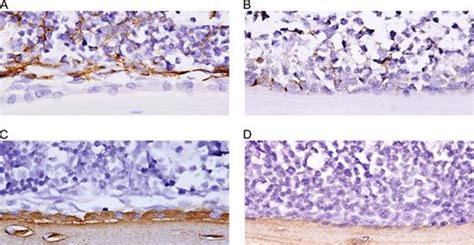 Osteal Tissue Macrophages Are Intercalated throughout Human and Mouse Bone Lining Tissues and ...