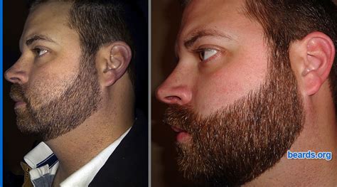 Repairing a bad neck line or cheek line for your full beard | All About BEARDS