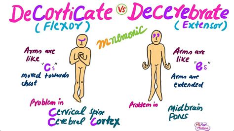 Decorticate Vs Decerebrate Rigidity,Mnemonic for USMLE | Mnemonics, Nursing mnemonics, Atrial ...