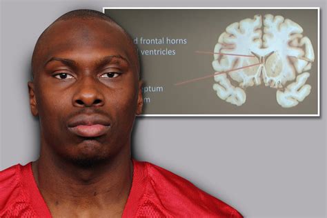 Phillip Adams suffered from 'severe CTE similar to Aaron Hernandez' before killing six and ...