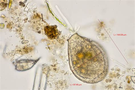 Arcella | The Microscopic Life of Shetland Lochs