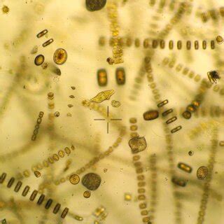 A look through the microscope at the natural phytoplankton community ...