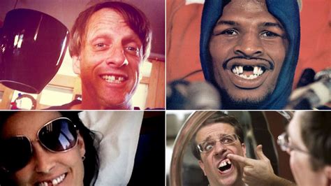 Charlie Sheen, Jim Carrey, Amy Winehouse: Toothless Celebrity Smiles (Photos)