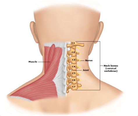 Cervical Spondylosis & Treatment