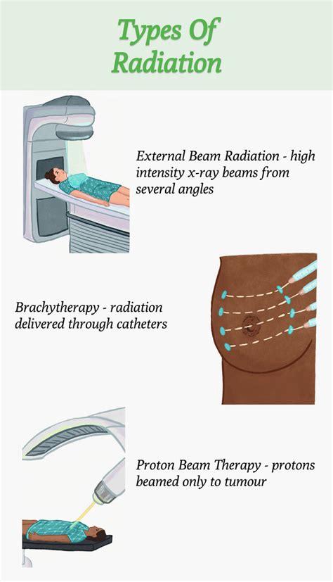 Cost of Radiation Therapy in India | Clinicspots 2024