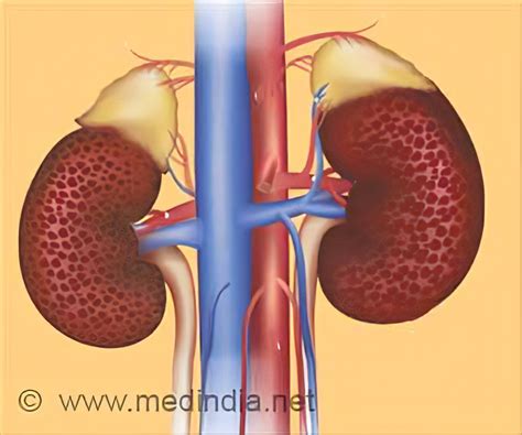 Protein Loss In Urine (Proteinuria) Symptoms, Causes And, 60% OFF