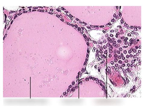 Thyroid Gland Histology Diagram | Quizlet