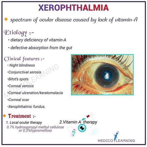 Diagnosis Of Xerophthalmia By Vital Staining Sauter, 1976, 41% OFF