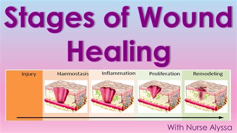 Wound Healing Steps