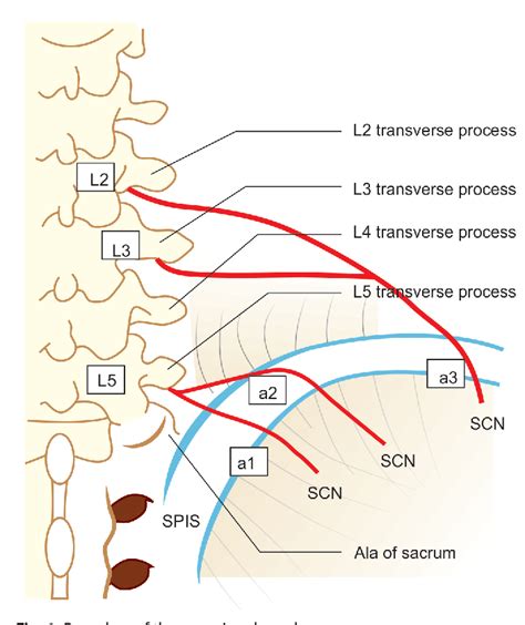 Figure 1 from Superior Cluneal Nerve Entrapment—Possible Pain Generator ...