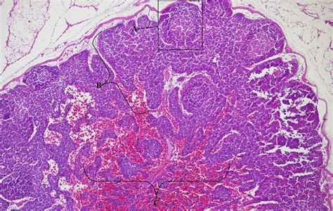 Lymph Node