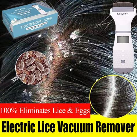 100%Eliminates Head Lice & Eggs Electric Lice Vacuum Remover Lice Eggs ...