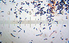 Lactobacillus acidophilus - Wikipedia