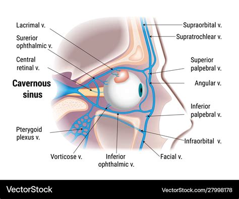 Pathogenesis cavernous sinus thrombosis Royalty Free Vector