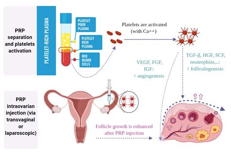 Endocrines | Free Full-Text | Ovarian Rejuvenation Using Autologous ...