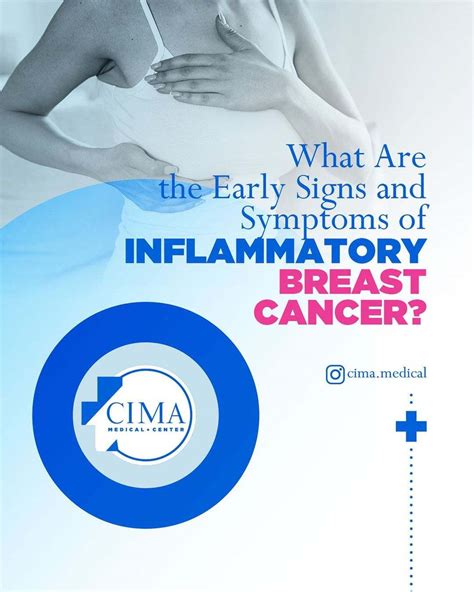 What are the Early Signs and Symptoms of Inflammatory Breast Cancer? | MiamiSprings.com | Miami ...