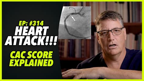 Ep:314 HEART ATTACK!!!! – CAC SCORE EXPLAINED - YouTube