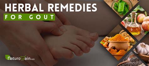 11 Best Herbal Remedies for Gout That Work Fast [Effectively]