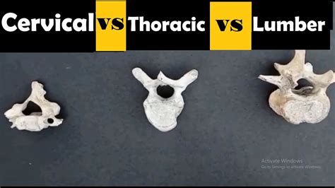 Cervical Thoracic Lumbar