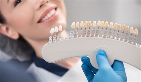 Porcelain Veneers: Procedure, Lifespan, Cost, and Pros & Cons