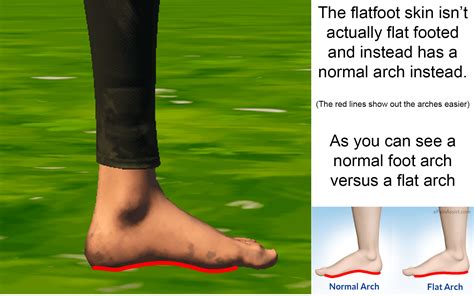 The flatfoot skin doesn't actually have flat feet! Literally unplayable. : r/FortNiteBR