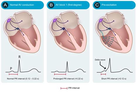 ECG Interpretation: Characteristics Of The Normal ECG, 57% OFF