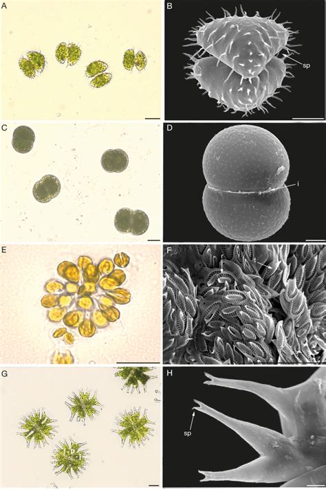 -A, B, Staurastrum polytrichum (MNHN-ALCP-2019-823.2), solitary cells... | Download Scientific ...