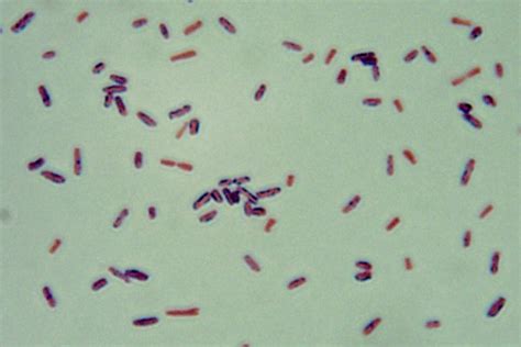 Clostridium Perfringens Gram Stain