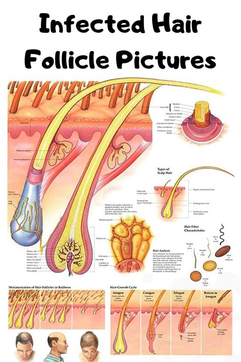 Infected Hair Follicle Pictures | Infected hair follicle, Hair chart, Hair science