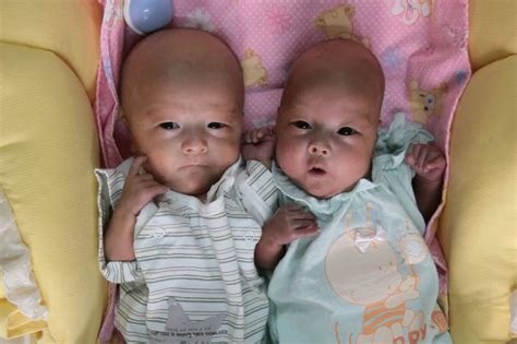 Identical Twin Sisters Spotted ‘Fighting’ in Mother’s Womb During ...