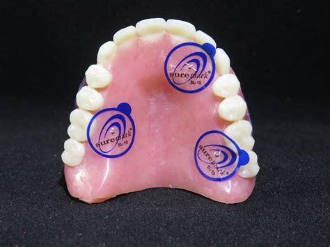 Fully Edentulous CBCT Scan: Dual Scan Protocol of Maxilla - Implant Concierge