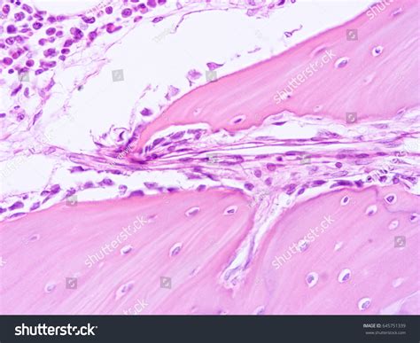 Histology Human Tissue Show Fibrous Cartilage Stock Photo 645751339 | Shutterstock