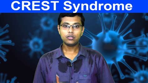 CREST syndrome | definition, causes, pathology, symptoms, diagnosis ...