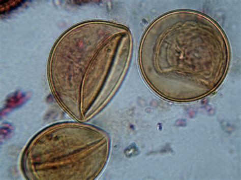 File:Tapeworm (Taenia) eggs.jpg - Wikimedia Commons