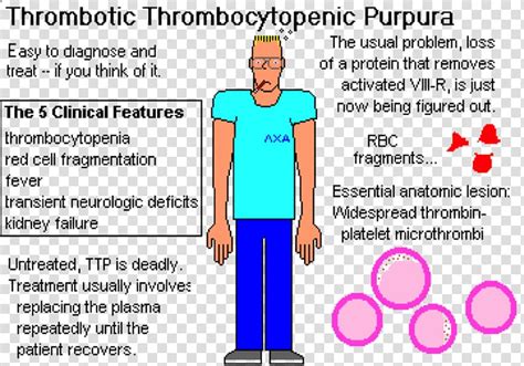 Thrombotic thrombocytopenic purpura, what to know?