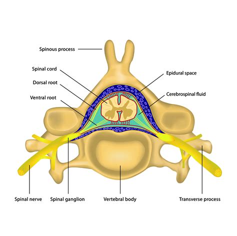 Epidural infiltrations for treating back pain | Orthopaedie ...